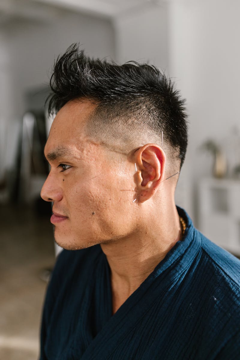 Side profile of a man receiving acupuncture treatment in a modern studio setting, promoting wellness.