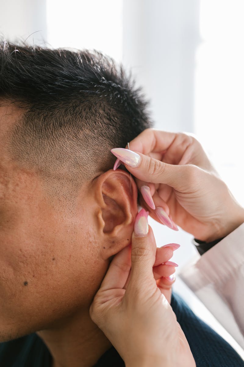 Detailed close-up of an acupuncture treatment performed on the ear for wellness.
